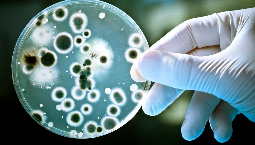 How to Measure Bacterial Growth in Petri Dishes