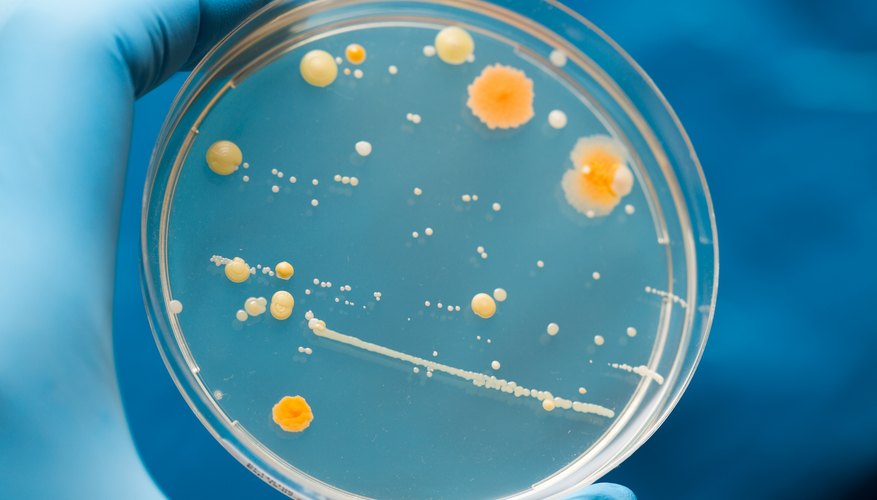 Nutritional Types of Bacteria | Sciencing