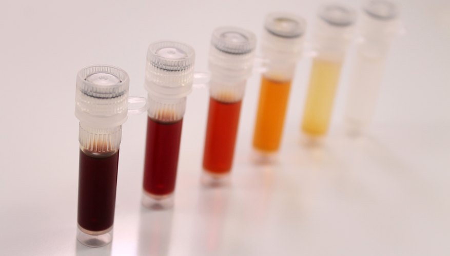 What are some advantages and disadvantages of the serial dilution agar plate technique (3 pts)