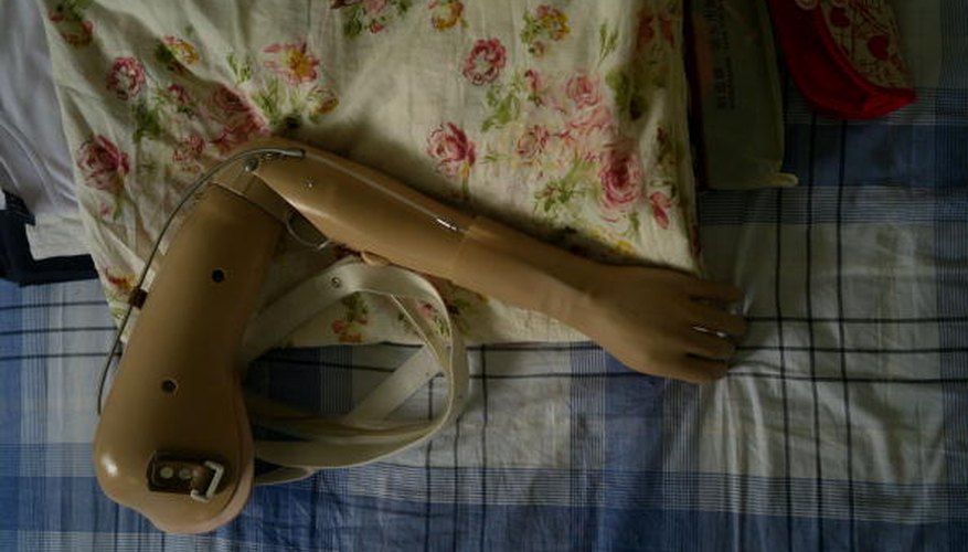 Photo Credit: China Photos/Getty Images News/Getty Images Artificial limbs are a common form of bionics.