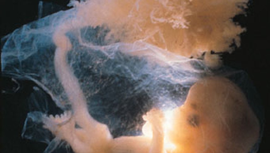 Photo Credit: Digital Vision./Digital Vision/Getty Images Growth in fetuses results from incredible rates of mitosis.