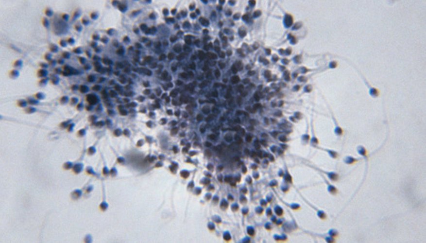 Photo Credit: Duncan Smith/Photodisc/Getty Images Male gametes are called sperm.