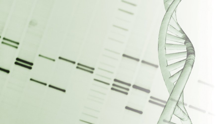 Photo Credit: Comstock/Comstock/Getty Images Karyotypes show if there are any chromosomal problems.