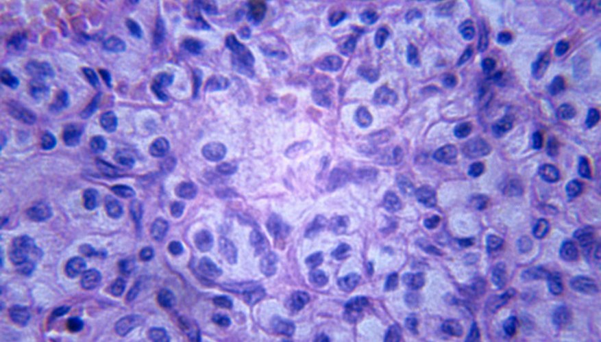 Photo Credit: Duncan Smith/Photodisc/Getty Images Uncontrolled, abnormal cell division differentiates cancer cells from normal ones.