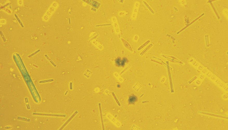 Photo Credit: Comstock Images/Comstock/Getty Images Diatoms have a unique, silica shell.
