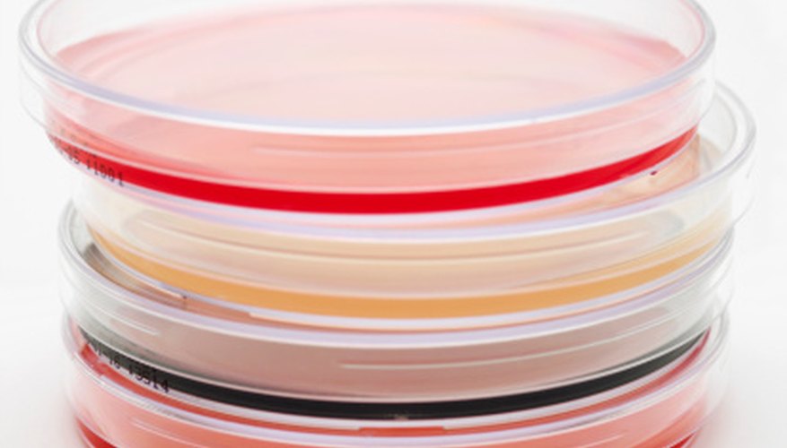 Photo Credit: Stockbyte/Stockbyte/Getty Images Agar plates provide a nutrient rich environment for a variety of organisms.
