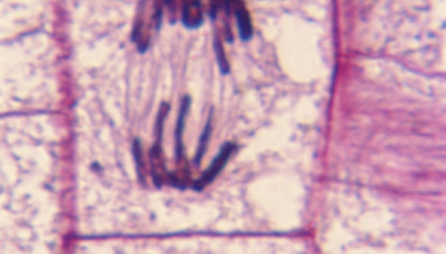 How to Identify Stages of Mitosis Within a Cell Under a ...