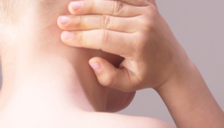 Photo Credit: Hemera Technologies/AbleStock.com/Getty Images Mite bites cause itching and redness, and possibly scarring.