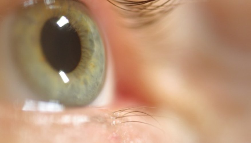 Photo Credit: Photos.com/Photos.com/Getty Images Polymers are the biomaterials used in contact lenses.