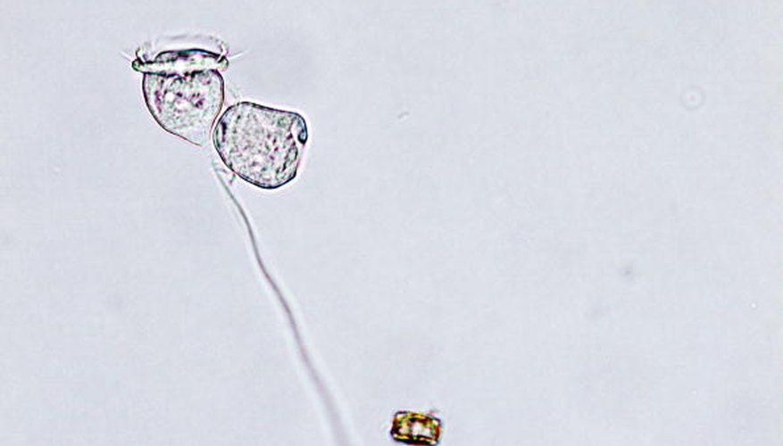Photo Credit: China Photos/Getty Images News/Getty Images Animal cells have certain universal differences from plant cells.