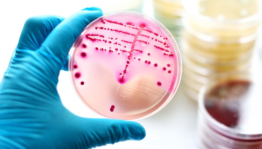 what-three-conditions-are-ideal-for-bacteria-to-grow-sciencing