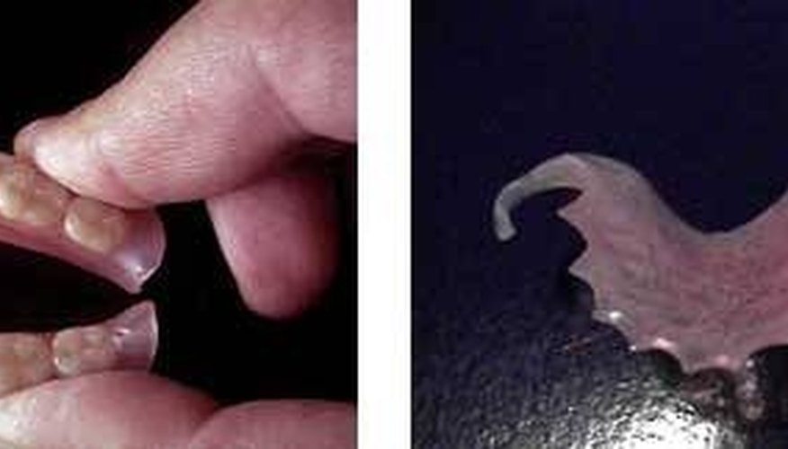 Flex Partial Dentures Flex Partial Dentures