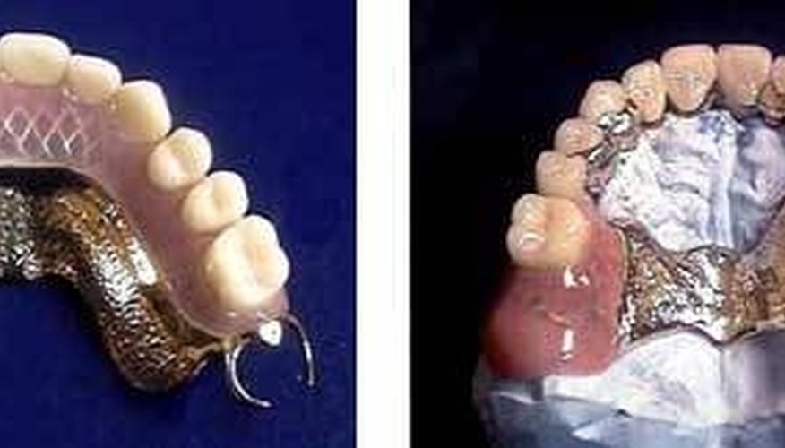 Partial Dentures Partial Dentures