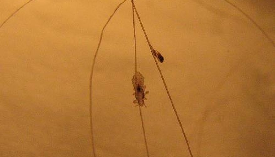 Head louse and nit Head louse and nit