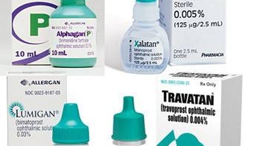 Lid discoloration is a side effect associated with glaucoma drops. Lid discoloration is a side effect associated with glaucoma drops.