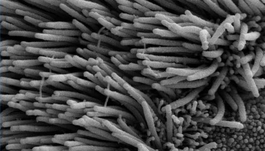 Scanning electron microscope image of cilia in lungs (public domain) Scanning electron microscope image of cilia in lungs (public domain)