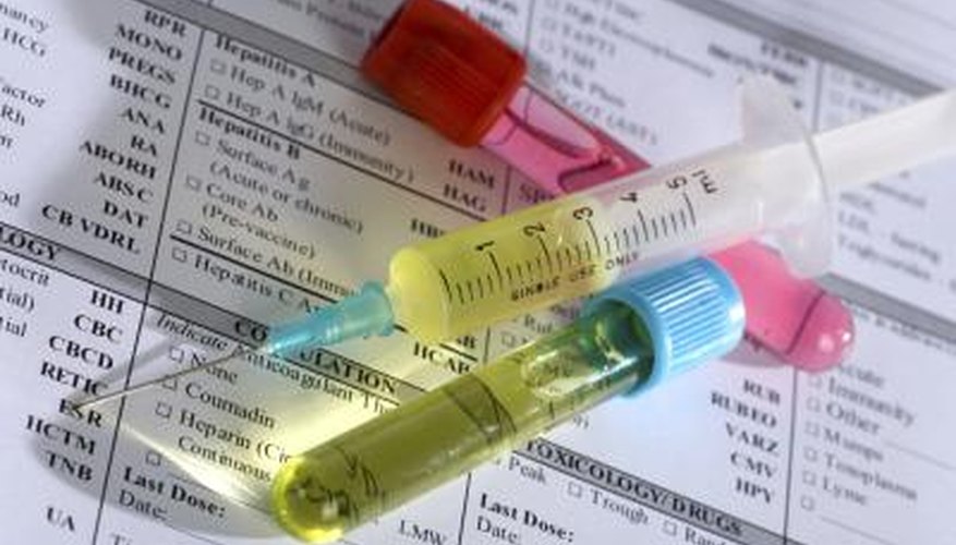 Close up of syringe and test tubes on medical chart. Close up of syringe and test tubes on medical chart.