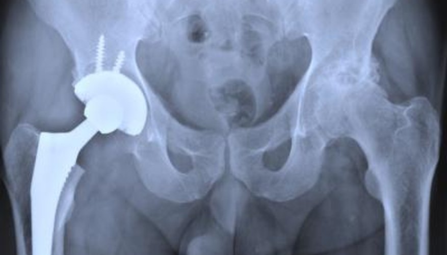 MRI Compatible Metals MRI Compatible Metals